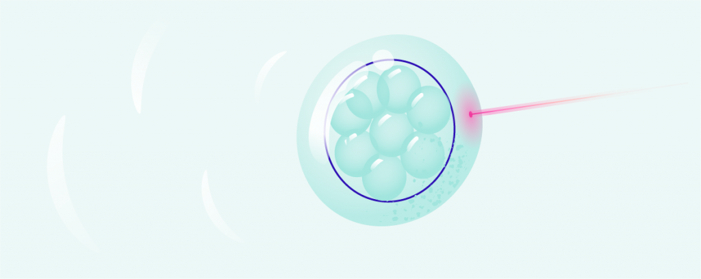 Assisted Hatching (Schlüpfhilfe): Erleichterung der Einnistung des Embryos hero-image