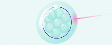 L’hatching assistito facilita l’annidamento dell’embrione hero-image