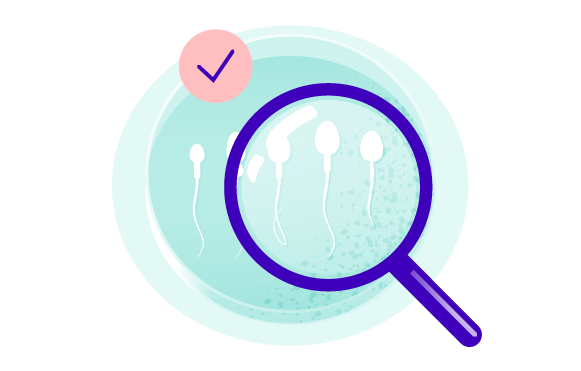 Semen analysis (spermiogram) image