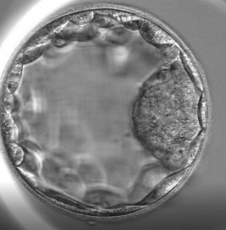 Blastocista: embrion star pet dana