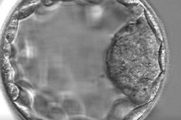 Blastozyste: ein fünf Tage alter Embryo thumbnail
