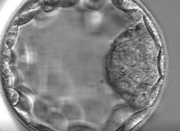 Blastocist: Embrion de cinci zile thumbnail