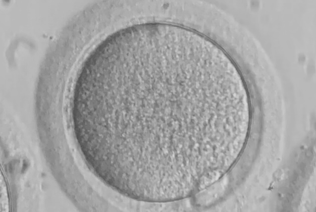 Ocena jakości pobranych komórek jajowych i zarodków thumbnail