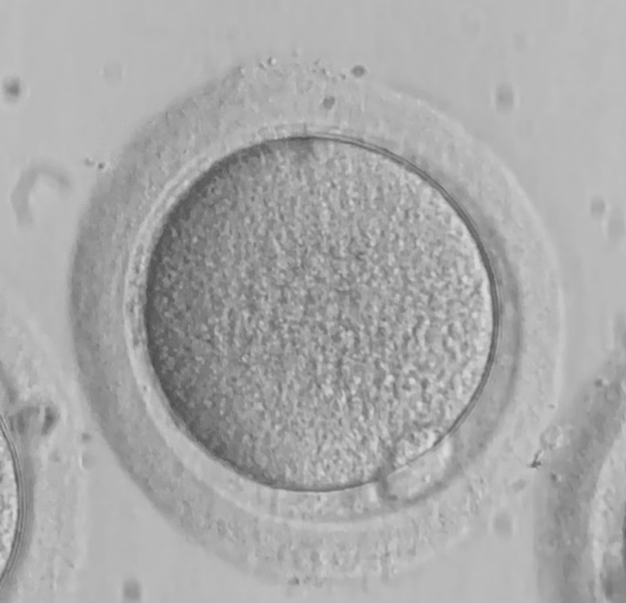 Evaluating the quality of collected eggs and embryos thumbnail
