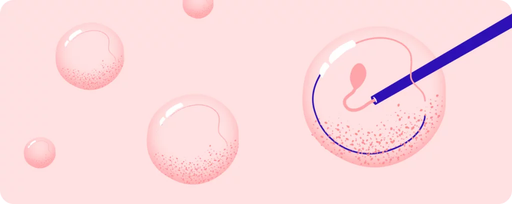 Eizellenspende: Zeitlich limitiertes Angebot  hero-image