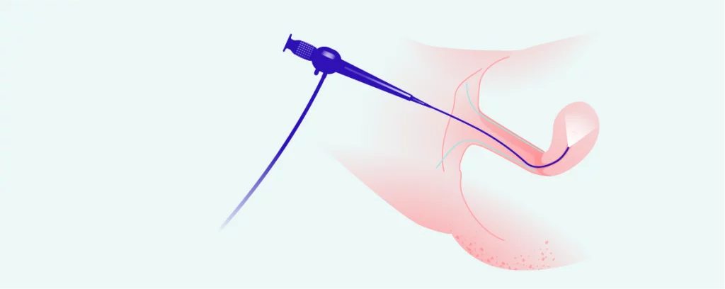 Hysteroskopie Praha hero-image