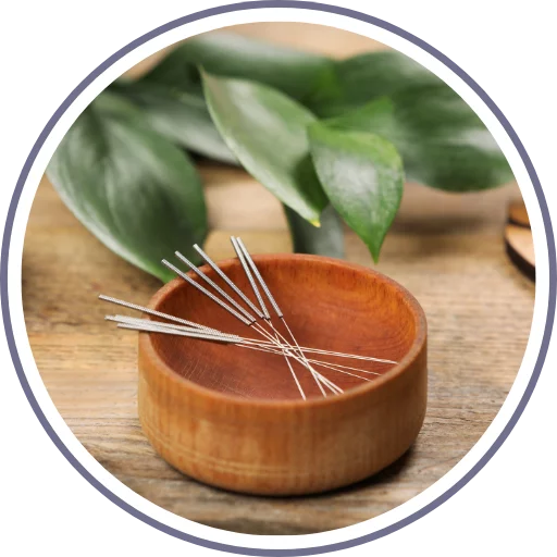 Akupunktura & IVF image